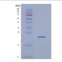 人真核翻译延伸因子1ε1(EEF1e1)重组蛋白