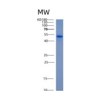 人ALDH5A1重组蛋白