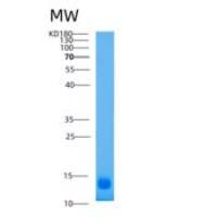 人激活素A受体ⅡA(ACVR2A)重组蛋白