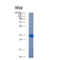 人耐酒石酸酸性磷酸酶(ACP5)重组蛋白