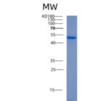 人醛脱氢酶3家族成员A1(ALDH3A1)重组蛋白