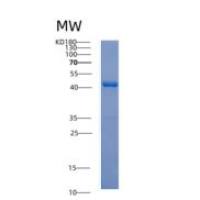人平滑肌肌动蛋白α2(ACTa2)重组蛋白