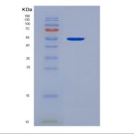 人酸性成纤维细胞生长因子(FGF1)重组蛋白