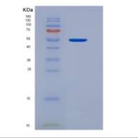 人酸性成纤维细胞生长因子(FGF1)重组蛋白
