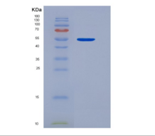 人酸性成纤维细胞生长因子(FGF1)重组蛋白