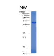 人乙酰辅酶A乙酰转移酶2(ACAT2)重组蛋白