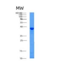 人肌动蛋白纤维关联蛋白1(AFAP1)重组蛋白