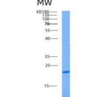 人腺苷酸激酶1(AK1)重组蛋白