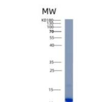 人AKAP7重组蛋白