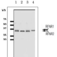 Anti-FNR | Ferredoxin NADP Reductase (root)
