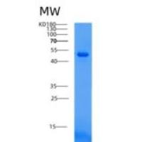 人溶血磷脂酸酸性磷酸酶(ACP6)重组蛋白