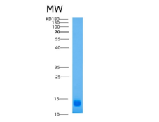 人激活素A受体ⅡA(ACVR2A)重组蛋白