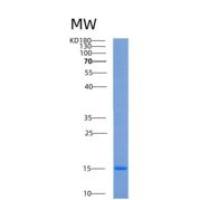 人野鼠色基因相关蛋白(AGRP)重组蛋白