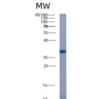 人AKR1B10重组蛋白