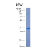 人辅肌动蛋白α1(ACTN1)重组蛋白