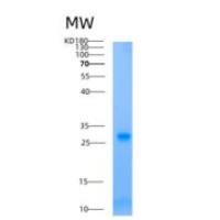 人AK2重组蛋白