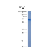 人ALDH5A1重组蛋白