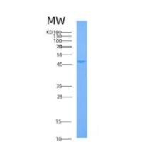 人ADH1C重组蛋白