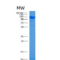 人AlaRS (Alanyl-tRNA synthetase)重组蛋白