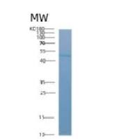 人酰基辅酶A脱氢酶短/枝链(ACADSB)重组蛋白