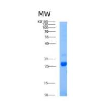 人AICDA重组蛋白