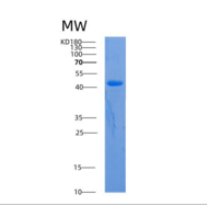人酰基辅酶A脱氢酶C4-C12直链(ACADM)重组蛋白
