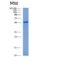 人ADPRHL2重组蛋白