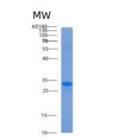 人ACBD6重组蛋白
