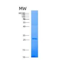 人AK4重组蛋白