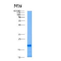 人AIF1L重组蛋白