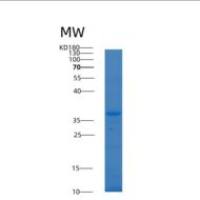 人Alcohol dehydrogenase重组蛋白