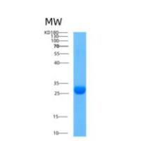 人Adenylate kinase 3(C22S)重组蛋白