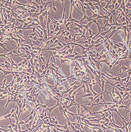 HSF人皮肤成纤维细胞（附STR鉴定报告）