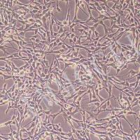 HFB人皮肤成纤维细胞、HFB细胞