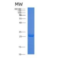 小鼠脂联素重组蛋白