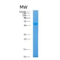 人Aflatoxin B1 aldehyde reductase member 2 (AKR7A2)重组蛋白