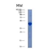 人AKR1D1重组蛋白