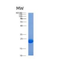 人前梯度蛋白2(AGR2)重组蛋白