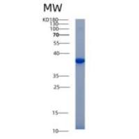 小鼠Akr1b1重组蛋白