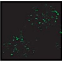 Anti-VPS35 | Vacuolar protein sorting-associated protein 35B (marker of PVC)