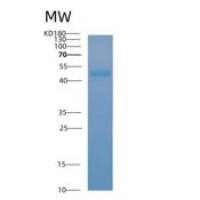 人酰基辅酶A脱氢酶C2-C3短链(ACADS)重组蛋白