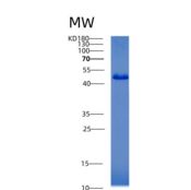 人乙酰辅酶A乙酰转移酶2(ACAT2)重组蛋白