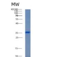 人醛酮还原酶家族1成员C4重组蛋白