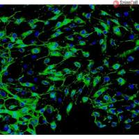 人子宫肌层微血管内皮细胞