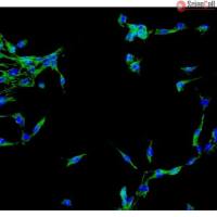 人脑血管外膜成纤维细胞