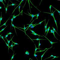 人表皮黑色素细胞-深色素 HEM-d (Sciencell进口)