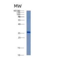 人醛酮还原酶家族1成员C3亚型重组蛋白