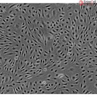 人脑微血管内皮细胞