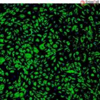 人脂肪微血管内皮细胞