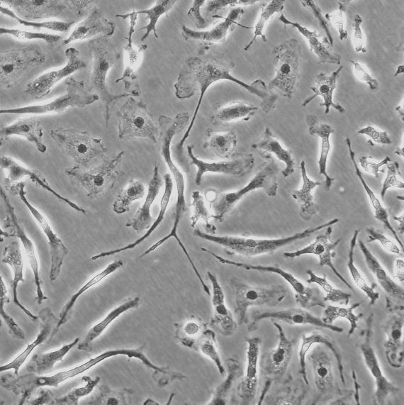 大鼠肝脏星形胶质细胞